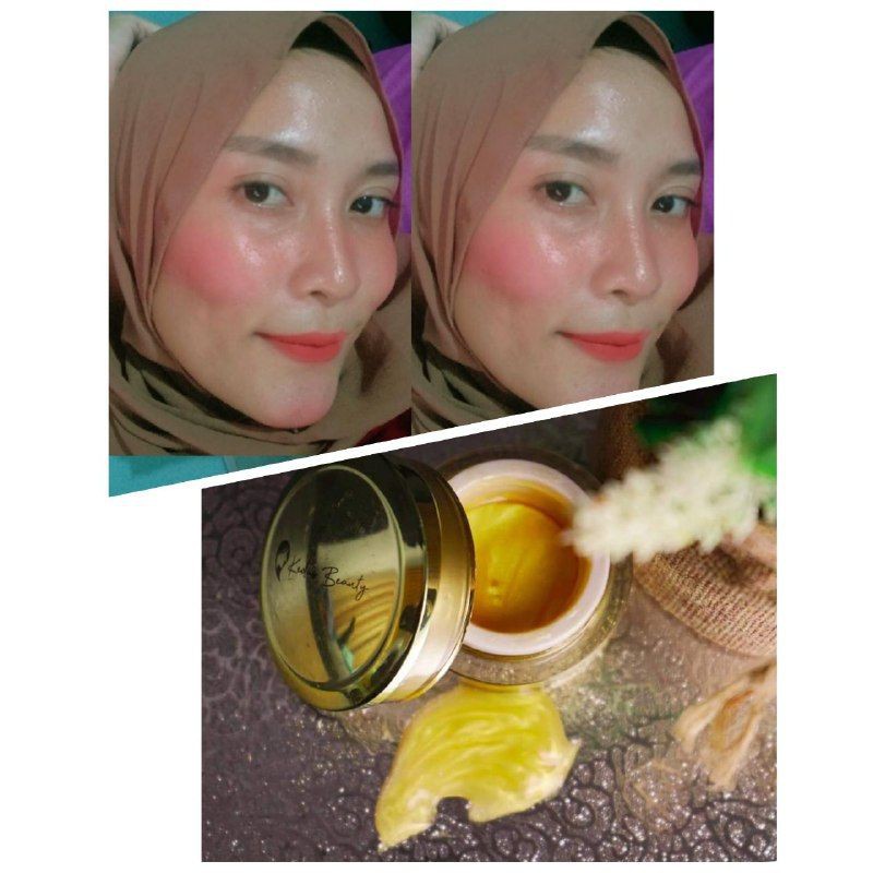 GOLD JELLY KEDAS / BRIGHTENING SOAP KEDAS BEAUTY ORIGINAL 100% BPOM /GLOWING WAJAH✅