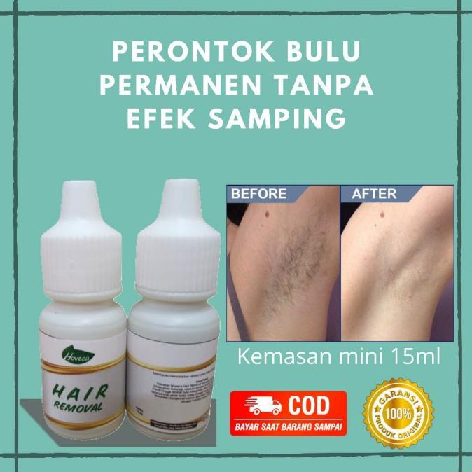 Obat Perontok Bulu Permanen Kumis, Jenggot, Kaki, Tangan,Miss V,Ketiak