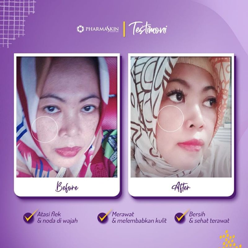 Pharmaskin Paket Skincare Intensive Night Cream Flek Hitam Menahun Perawatan Wajah Menghilangkan Noda Hitam Resmi Halal BPOM Ampuh Original-5