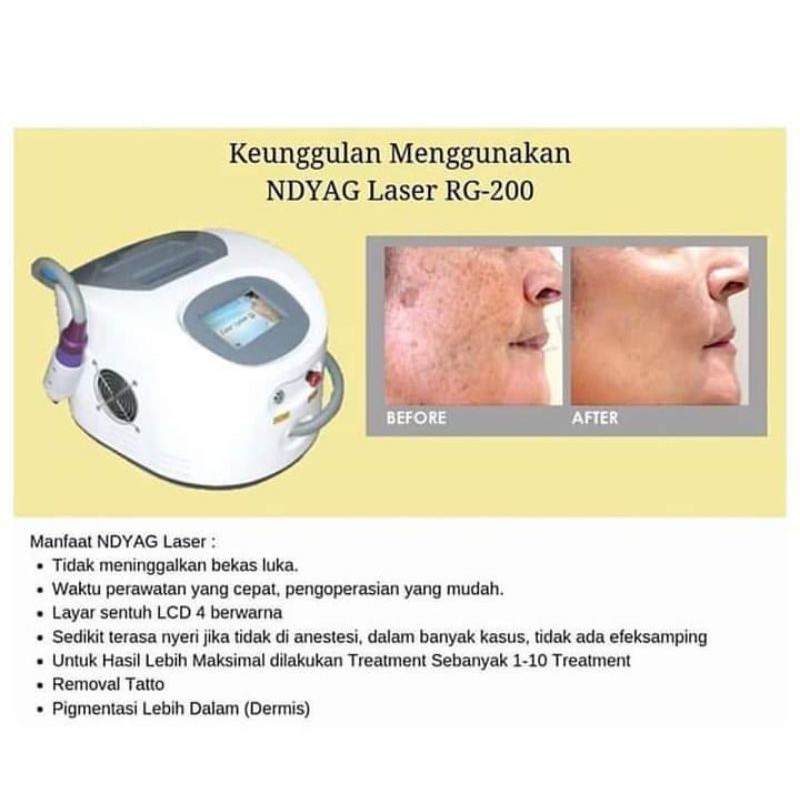 Alat Kecantikan Mesin Laser Nd Yag