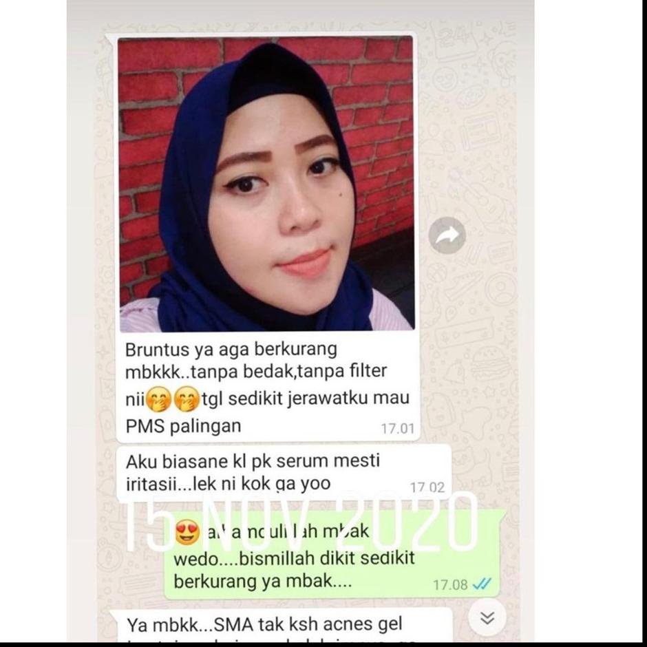 ✲ SERUM ADERA FACE SERUM ORIGINAL WAJAH ORI UNTUK FLEK HITAM GLOWING ORI ASLI 100% ✧