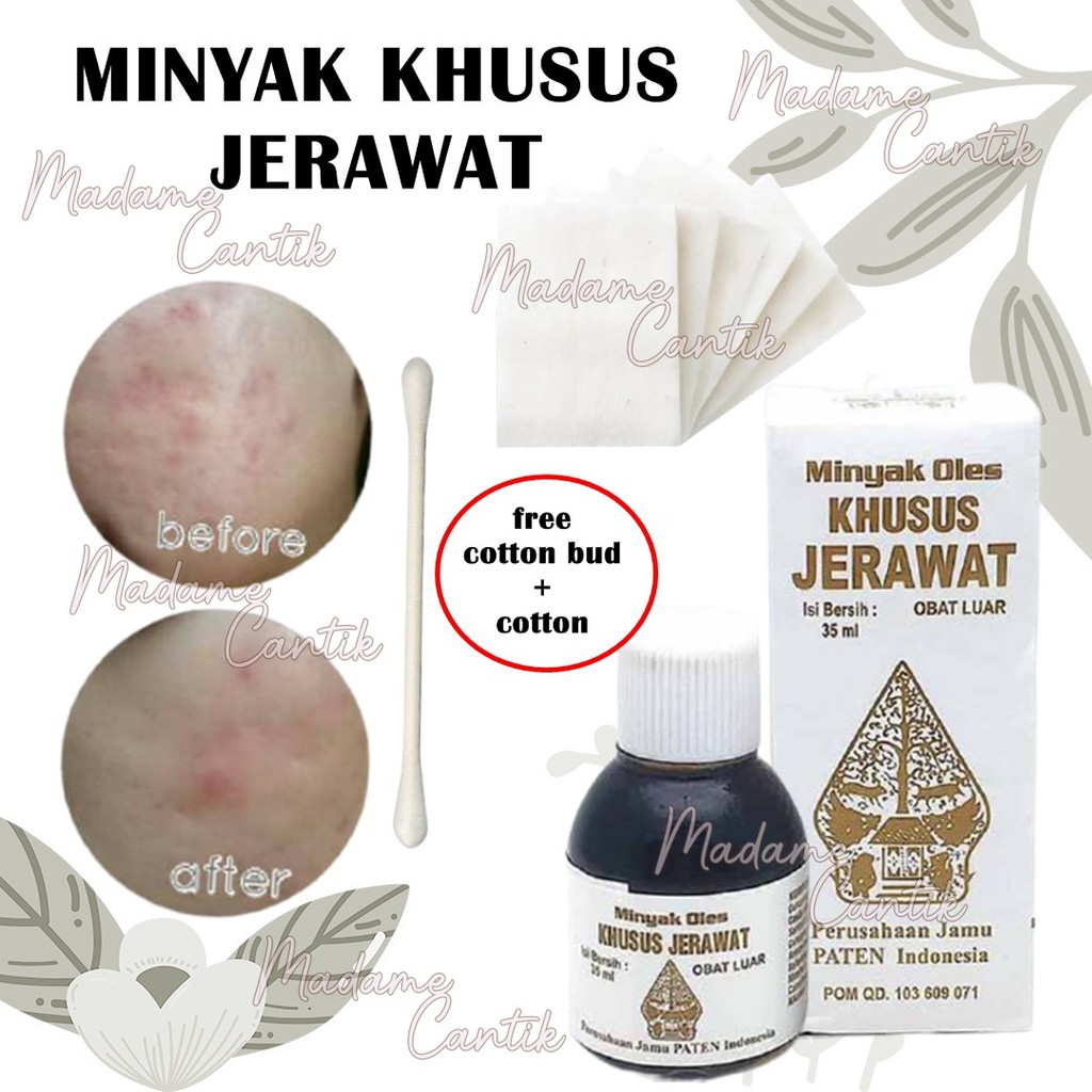 ✿ MADAME ✿ WAYANG OBAT JERAWAT / MINYAK PENGEMBUH JERAWAT