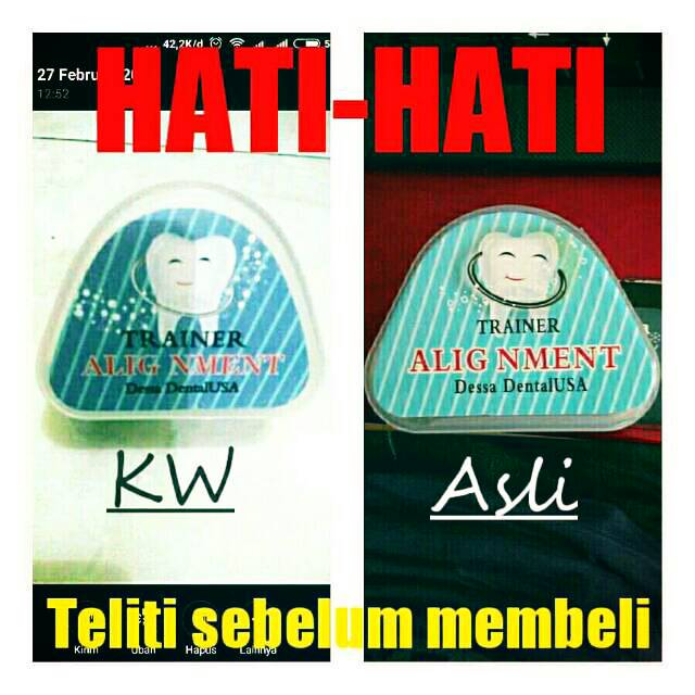Perapih Gigi Behel Teeth Trainer Alignment Original Merapikan Tonggos Gingsul Perapi Gigi Lentur Ori
