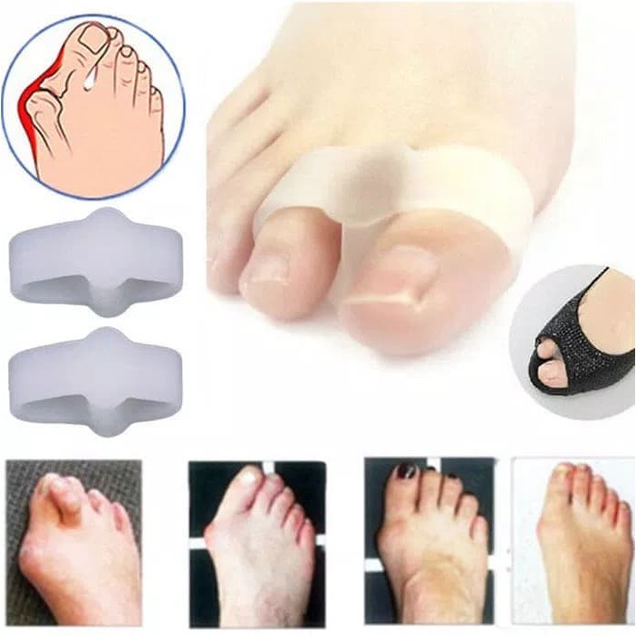 Pemisah jari kelingking gel silicone bunion separator  hallux valgus