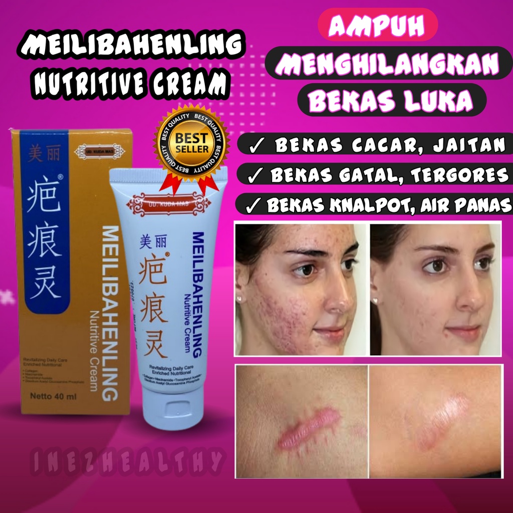 MEILIBAHENLING NUTRITIVE CREAM OBAT PENGHILANG BEKAS LUKA CREAM SALEP OBAT PEMUTIH KULIT TUBUH ORIGINAL | SCAR CREAM BEKAS CACAR JAITAN PENGHILANG LUKA BAKAR KNALPOT LUKA AIR PANAS