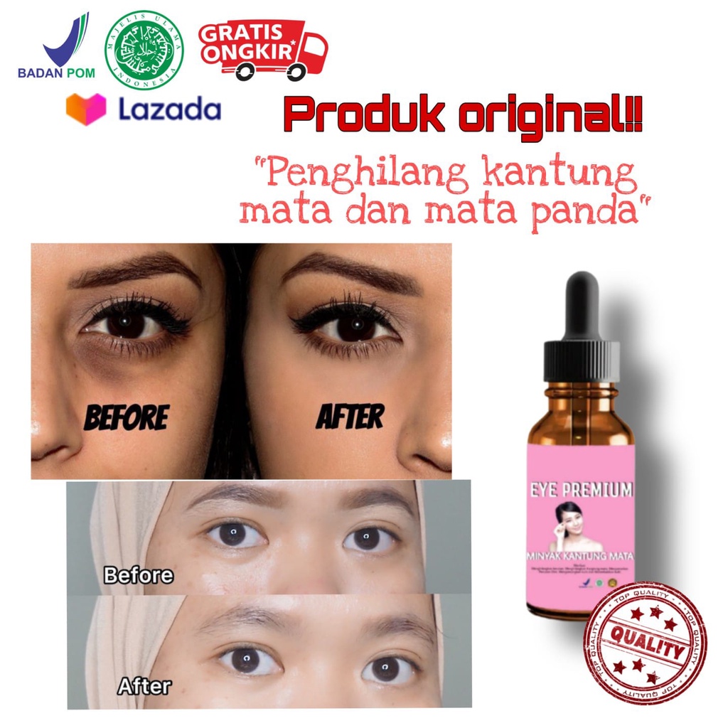 [PROMO MENARIK] eye premium/penghilang mata panda/penghilang mata panda ampuh/penghilang mata panda 