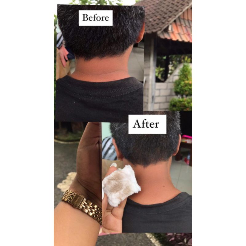 [READY STOCK]Toner Badan by Yoniskincare