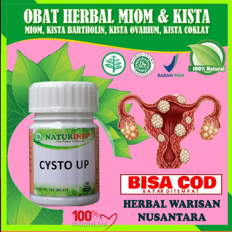 Jual Obat Kista Ovarium Miom Endometriosis Bartholin Ganglion Benjolan