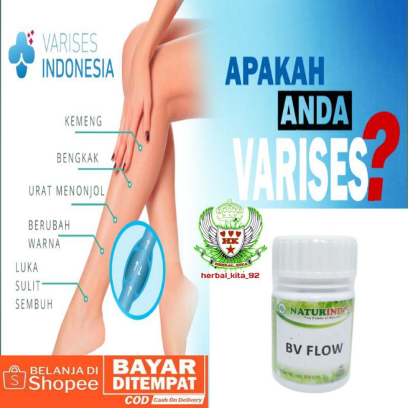 OBAT HERBAL VARISES PALING AMPUH,FARISES,PARISES,URAT,KAKI BETIS VARISES,TANGAN VARISES BISA COD