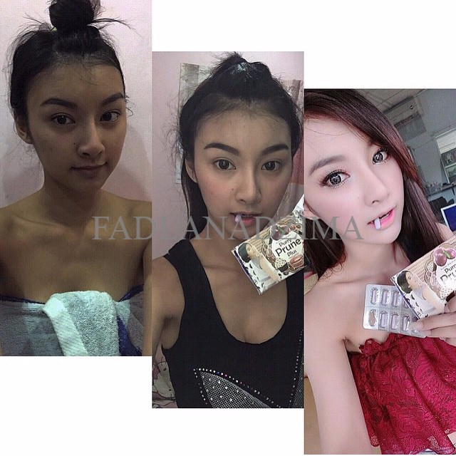 PURRY PRUNE PLUS BY LITTLE BABY - Suplemen Pelangsing+Pemutih