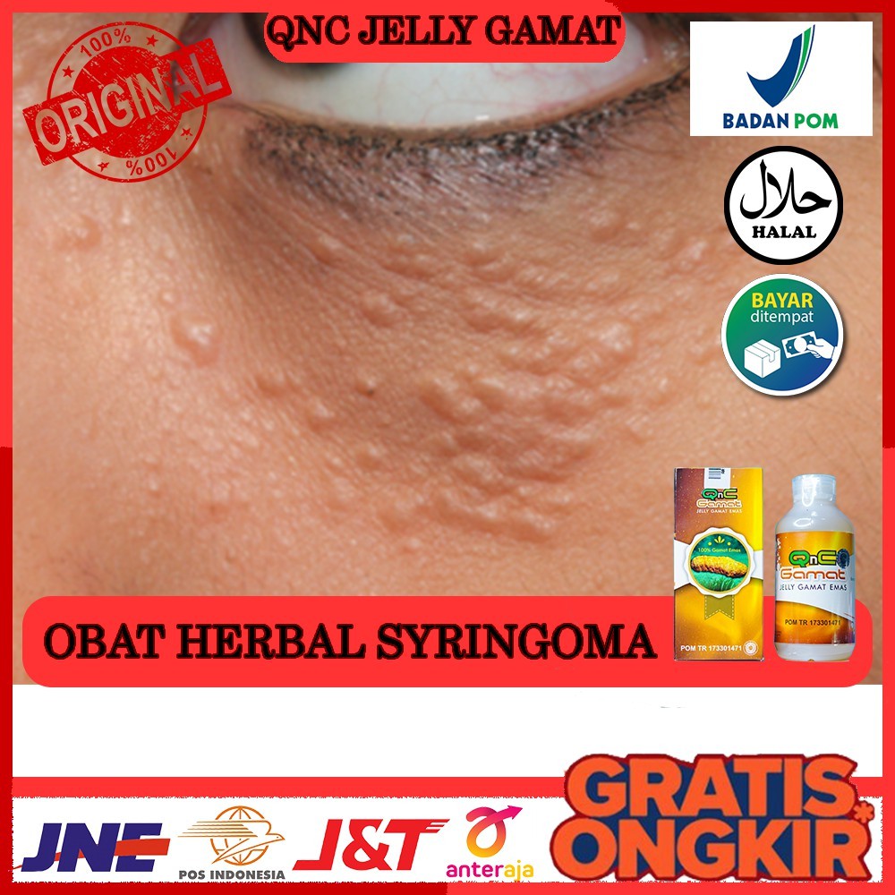 Obat Alami Syringoma, Obat Milia - Qnc Jelly Gamat - Bisa Bayar di Tempat COD - Halal & MUI