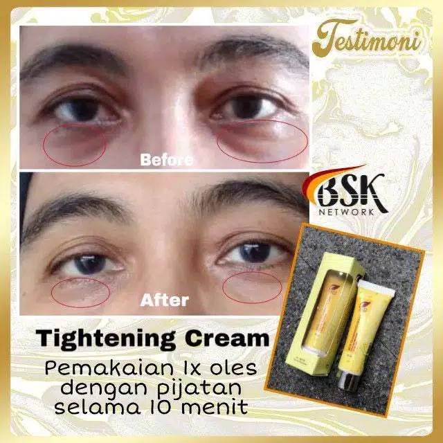 TIGHTENING CREAM SR12 / WHITENING TERBAIK / PENCERAH WAJAH / PENGENCANG ANTI KERUT WAJAH / HERBAL TIGHTENING CREAM SR12 / Krim hilangkan kerutan dalam 10 menit  Skin Tightening krim sr12