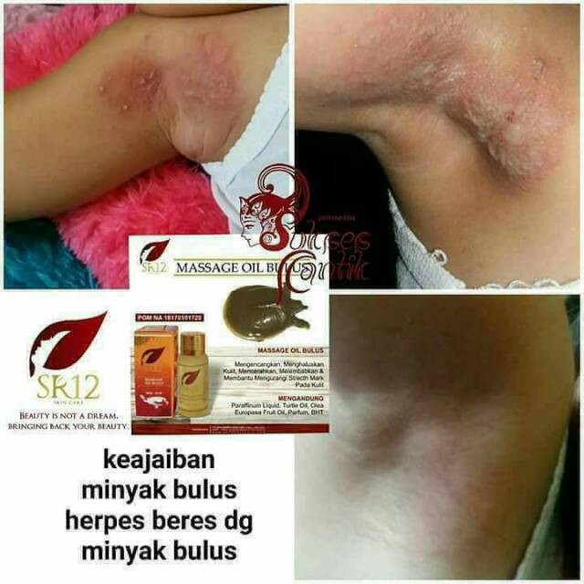 SPESIAL BULUS SR12 / Minyak Bulus/ Sabun Bulus/ Facial Wash Bulus/ sr12 skincare/ kosmetik bpom