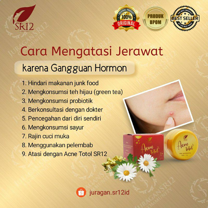 KRIM JERAWAT TOTOL SR12 BPOM AMAN / MENGEMPESKAN JERAWAT / CREAM TUMPAS JERAWAT / PERAWATAN JERAWAT