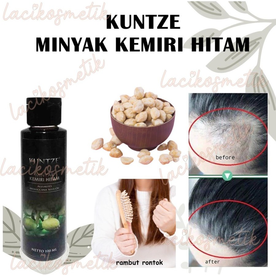 ✨LACIKOSME✨ KUNTZE MINYAK KEMIRI HITAM BPOM