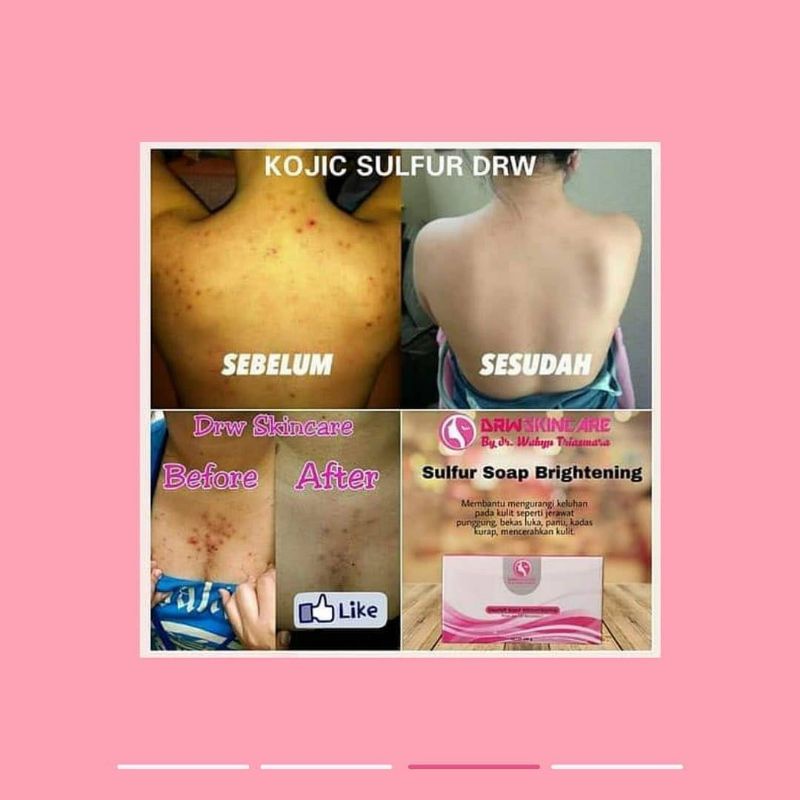 SABUN PEMUTIH Ekstra Whitening (Kojic Milk &amp; Sulfur) by drw skincare