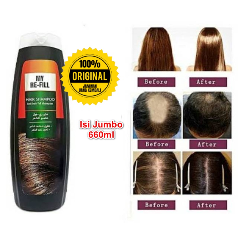 Shampo REFILL MY WAY - Sampo Anti Rontok - Perawatan dan Penyubur Rambut