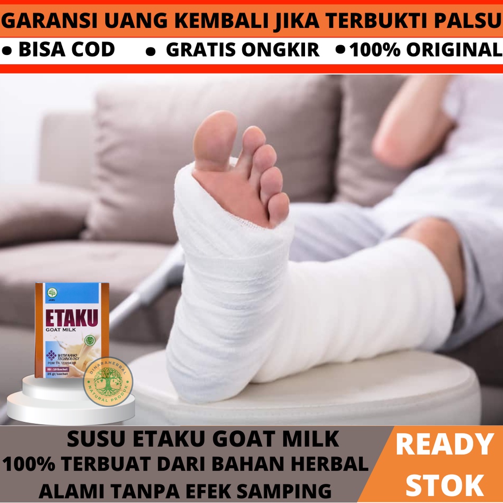 SUSU KAMBING ETAKU, Susu Sembuhkan Patah Tulang, Susu Patah Tulang Retak, Susu Penambah Kalsium, Sus