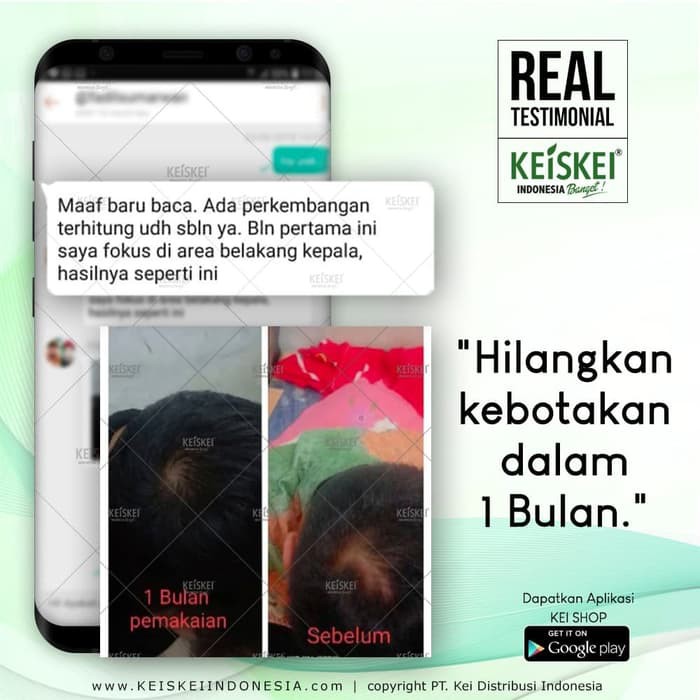 Promo Paket Perawatan Rambut Rontok Berketombe | S2