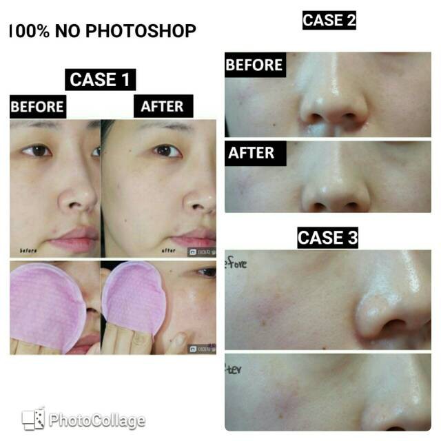 NEOGEN Bio Peel Gauze Peeling [sachet]