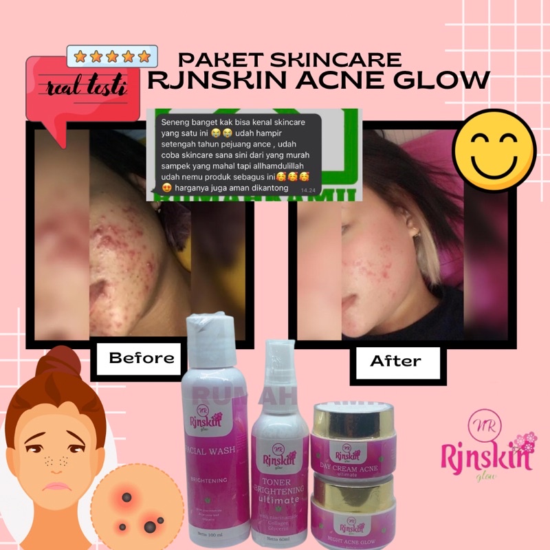 RJNSKIN Cream BPOM paket skincare pemutih wajah ampuh NRglow cream glowing terlaris untuk jerawat kl