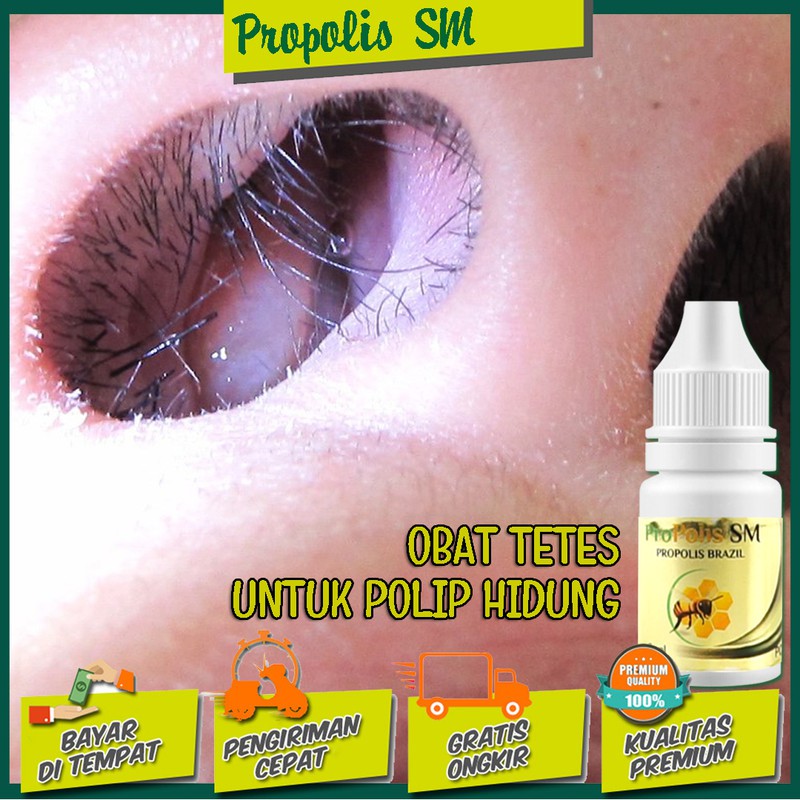 Obat Tetes Untuk Polip Hidung - Hidung Mampet - Hidung Kesumbat - Sinusitis [Propolis Brazil SM]
