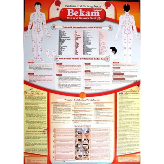 Jual Poster bekam / gambar titik bekam/ foto titik bekam | Shopee Indonesia