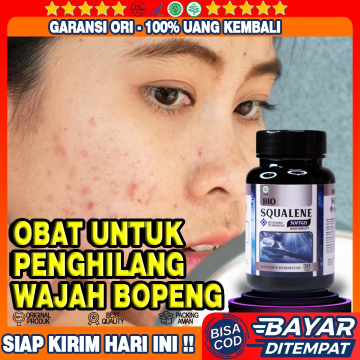 Obat Membantu Hilangkan Bopeng Jerawat - Obat Jerawat Bopeng Parah - Obat Bopeng Alami - Obat Komedo
