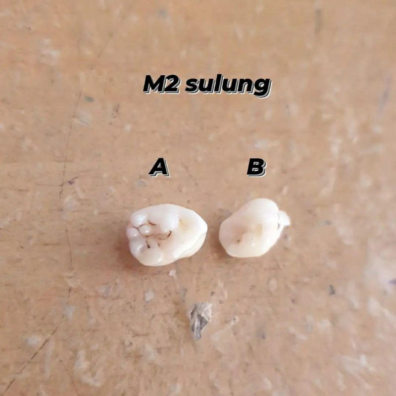 molar2 sulung RB gigi asli praktikum FKG