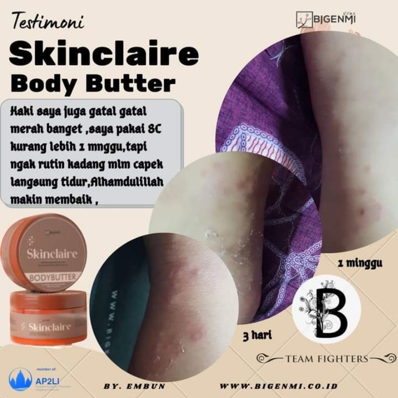 SKINCLAIRE BODY LOTION DNA SALMON WHITENING PERMANEN TANPA SUNTIK PEMUTIH HASIL CEPET