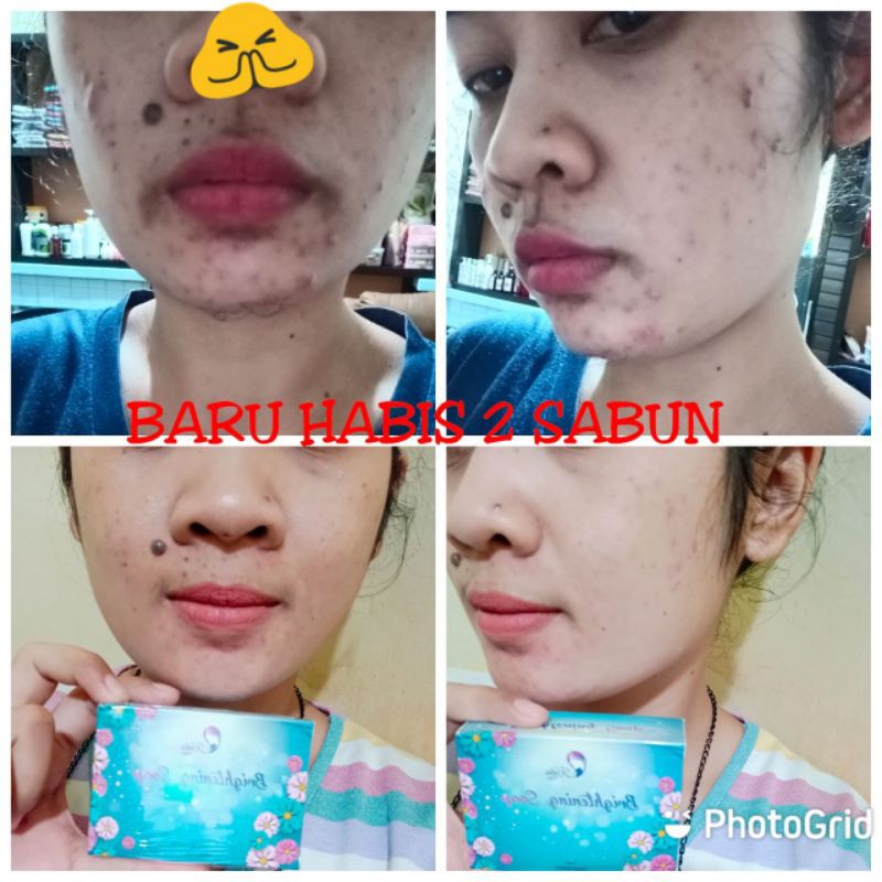 KEDAS BEAUTY SABUN KEDAS / BRIGHTENING SOAP / SABUN PEMUTIH 100Gr-3