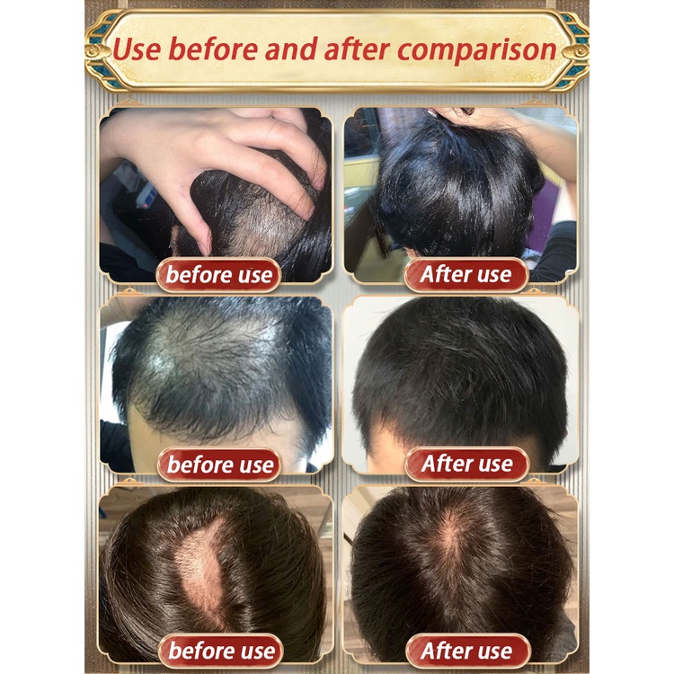 Shampo Jahe 500ml Shampo Penumbuh Rambut Tebal Anti Ketombe Gatal Anti Rambut Rontok Fast Grow Shampoo Perawatan Rambut Rontok