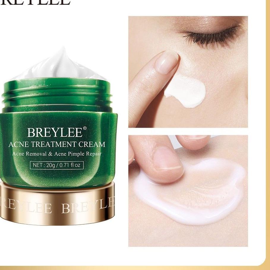 [WS1275] [BPOM] BREYLEE Acne Treatment Serum Blackhead Mask Cream Vitamin C Pimple Patch Day Night N