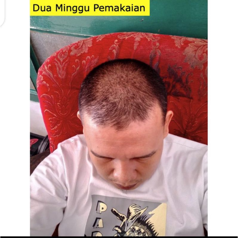 KELAYA SHAMPOO HAIR TREATMENT/PROMO BELI 2/SHAMPO ANTI RONTOK SHAMPOO RAMBUT RONTOK-4