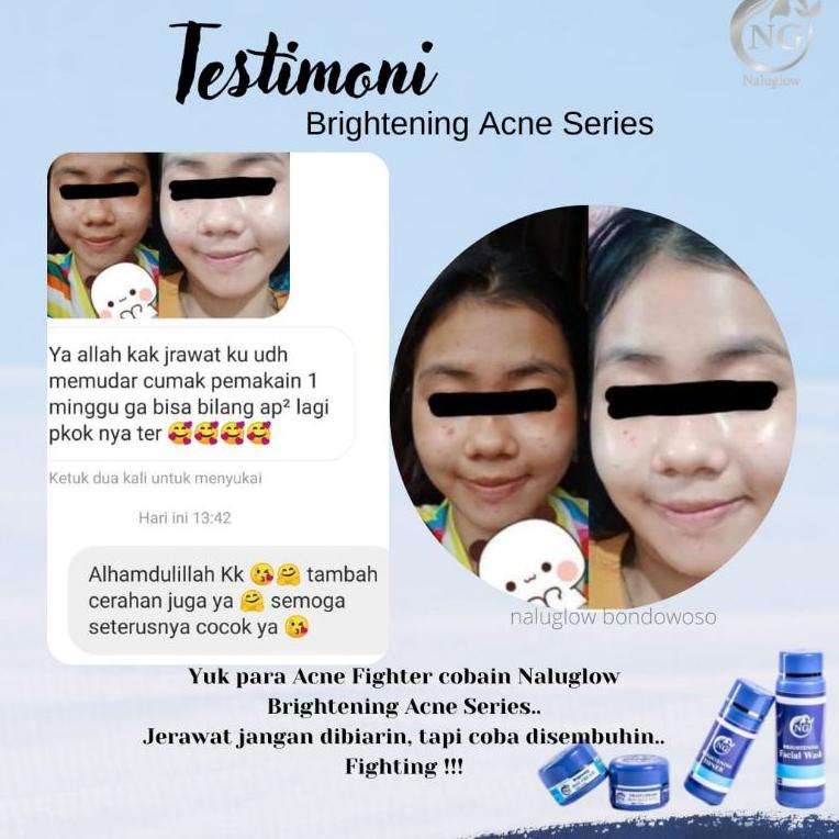 STOK BANYAK 8128 SKINCARE BPOM NALUGLOW || NALU GLOW SKINCARE WHITENING || KRIM JERAWAT || KRIM FLEK