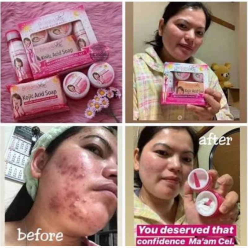 brilliantskin rejuvenating facial set