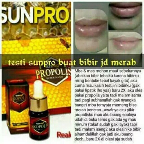 PEMERAH BIBIR PERMANEN - PROPOLIS SUNPRO NANO - KEKEBALAN TUBUH - OBAT SARIAWAN - PROPOLIS SUNPRO