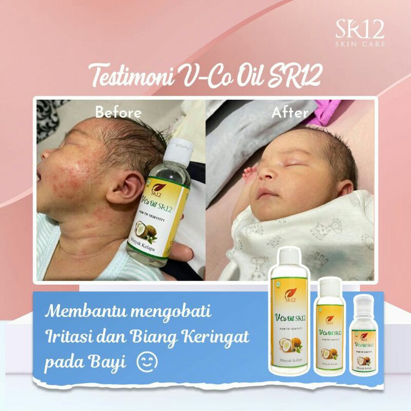 VCO SR12 Untuk Ruam Popok / Minyak Bayi / Biang Keringat / Minyak Kelapa Untuk Bayi / Obat Eksim Bruntusan Dermatitis Kulit Berkerak Bayi Anak