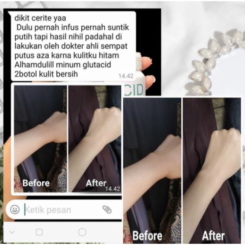 Glutacid Original Murah Whithening 16 000 Mg Original Whitening Booster Obat Pemutih Wajah - Badan - Glutacid Original Whitening Booster 16 000mg Obat Suplemen Herbal Glutacid Asli 100% Original