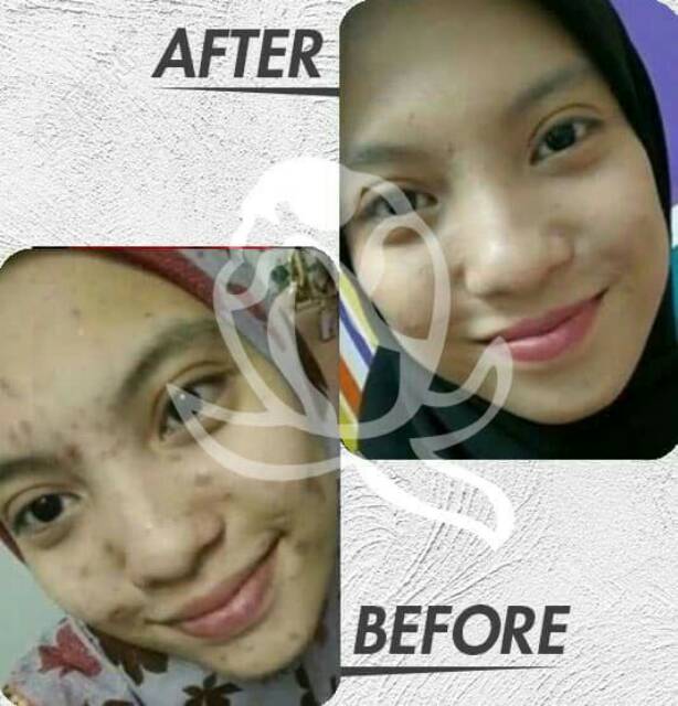 MELLYDIA NIGHT CREAM PEMUTIH PENCERAH WAJAH AMAN BPOM - MELLYDIA BPOM