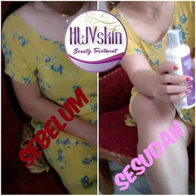 

Hwskin