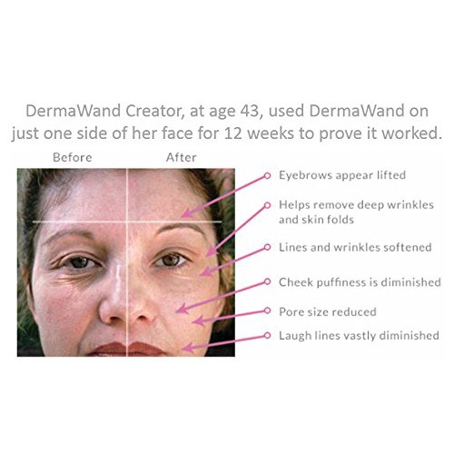 Derma Wand As Seen On TV