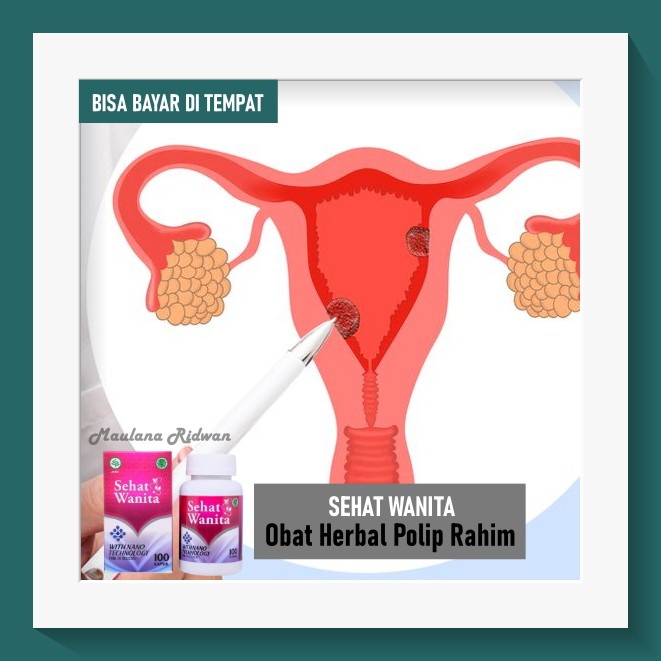 Obat Polip Rahim, Tumor Rahim, Kista Rahim, Obat Benjolan Rahim Herbal Sehat Wanita