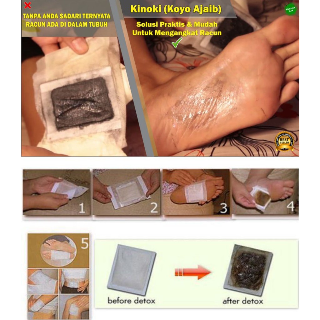 KOYO KINOKI GOLD JAHE/ KINOKI GOLD DETOX FOOT PADS GINGER