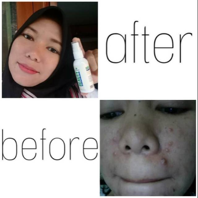 Natura Beauty Spray Collagen & Glutathione