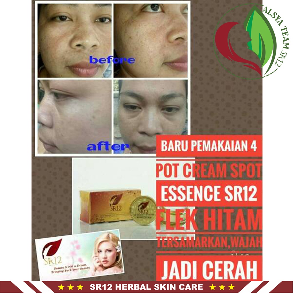 Spot Essence SR12 | Spot Essence Day Cream &amp; Spot Essence Night Cream | Krim Wajah SR12 Skincare