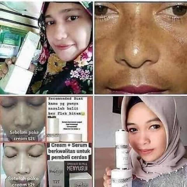 T2T cream dan serum