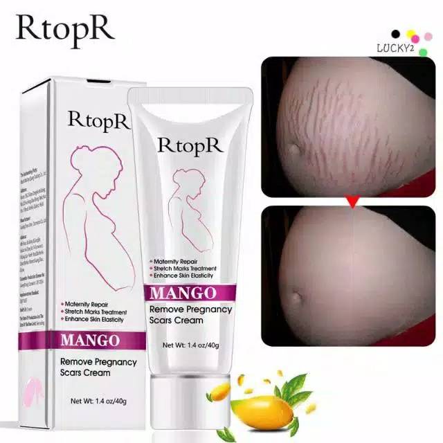 [COD] RtopR Mango Remove Pregnancy Scars Cream