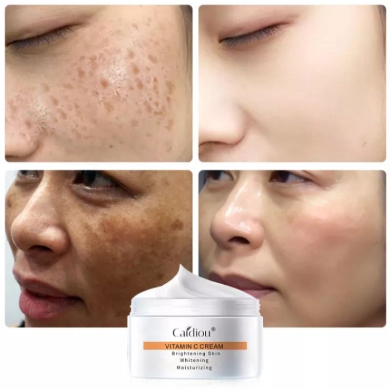 CAIDIOU VIT C BRIGHTENING CREAM | CREAM PEMUTIH WAJAH, HILANGKAN FLEK BANDEL, KULIT HITAM, ANTI KERIPUT