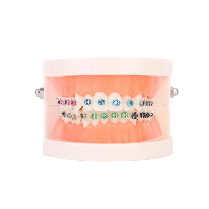 Dental model ortho study model orthodontic phantom studi behel braces bracket kawat gigi metal